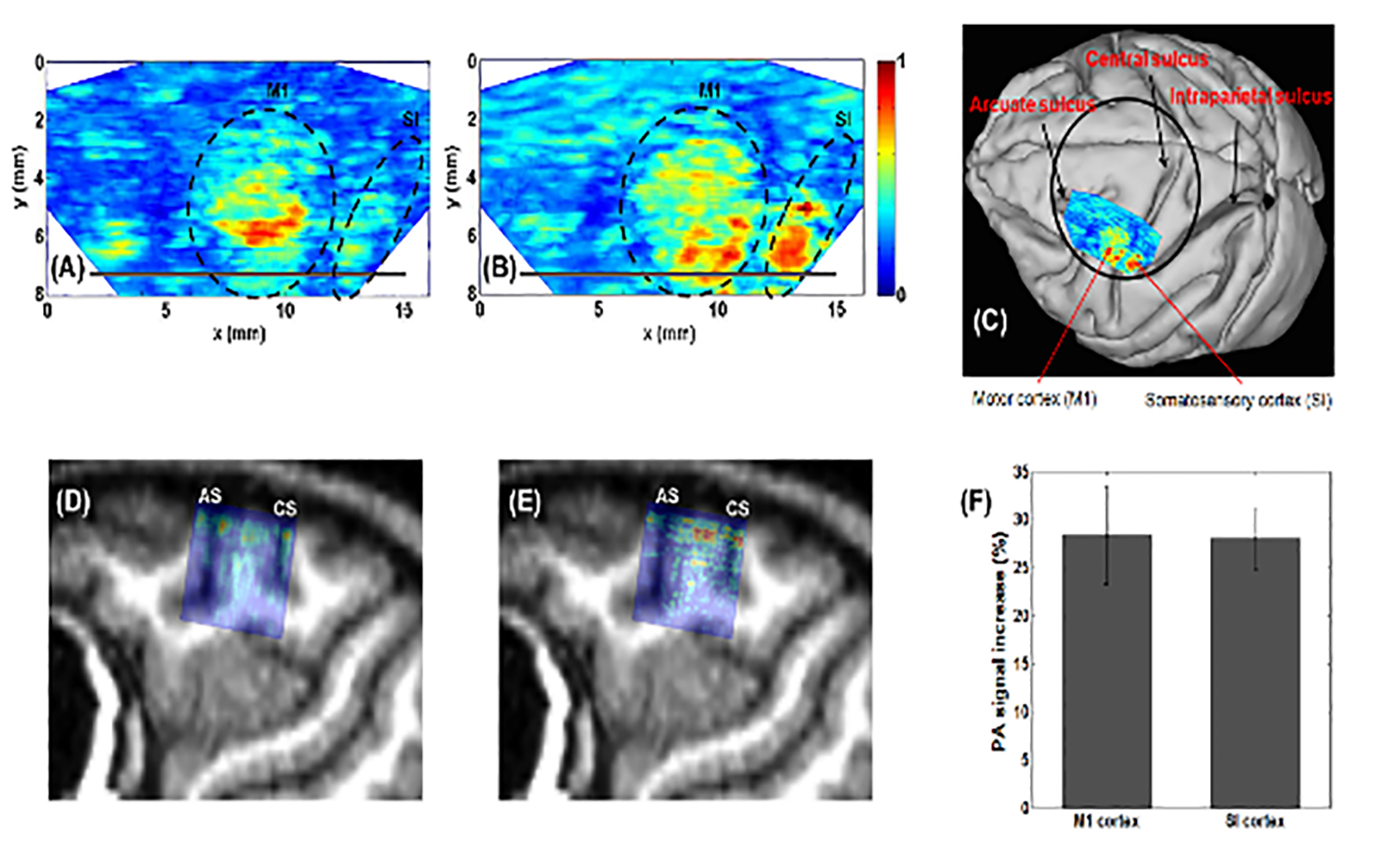 Images of the brain created with photoacoustic imaging