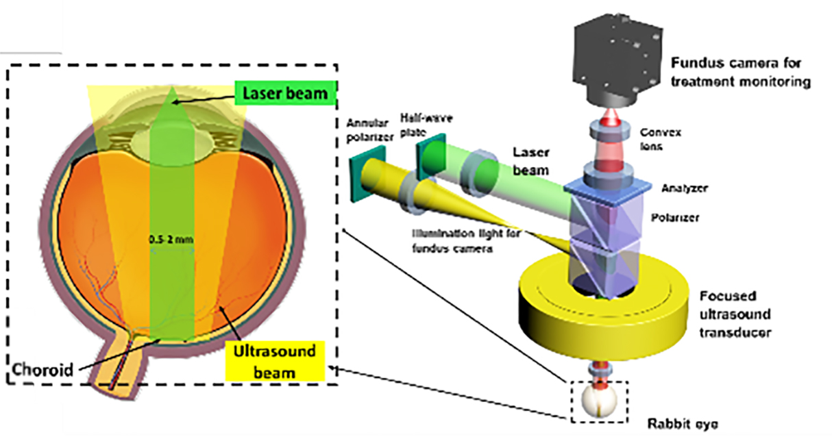 Photo-mediated ultrasound therapy