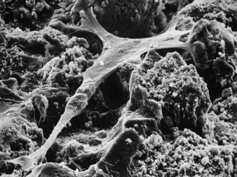 Closeup of tissue